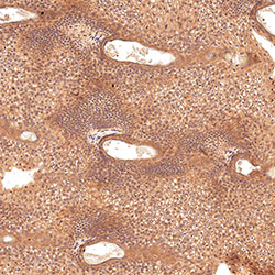 sars-cov-2 gene expression in a human fetus